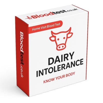 Dairy Intolerance Test Options to Explore in Oxford