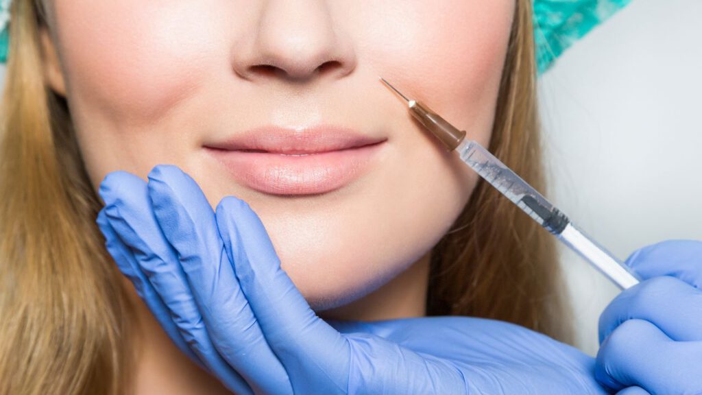 Lip Filler Simulation for Your Ideal Aesthetic Vision